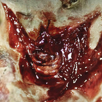 Zombie Torn Throat 3D Fx Transfer - Medium