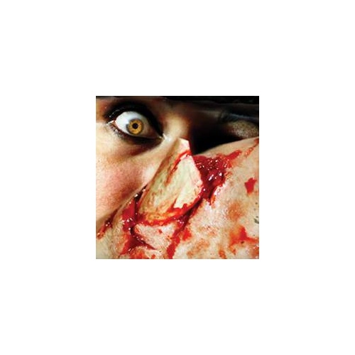 Bone Fracture 3D Fx Transfer - Medium